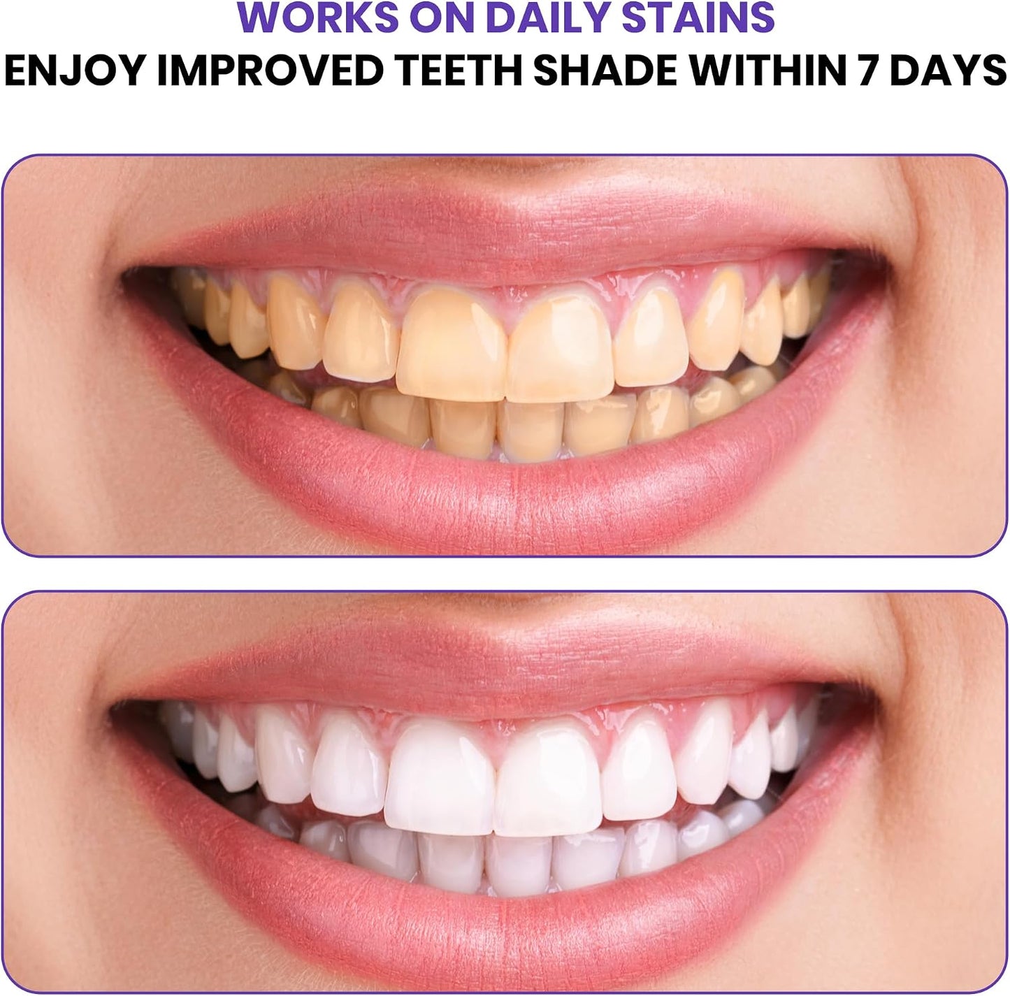 Purple Teeth Whitening Strips | Professional Teeth Whitening & Color Correction Tech | Enamel Safe | Zero Residue | Dry & Non-Slip | Removes Coffee, Wine & Smoking Stains | 14 Strips 7-Day Supply