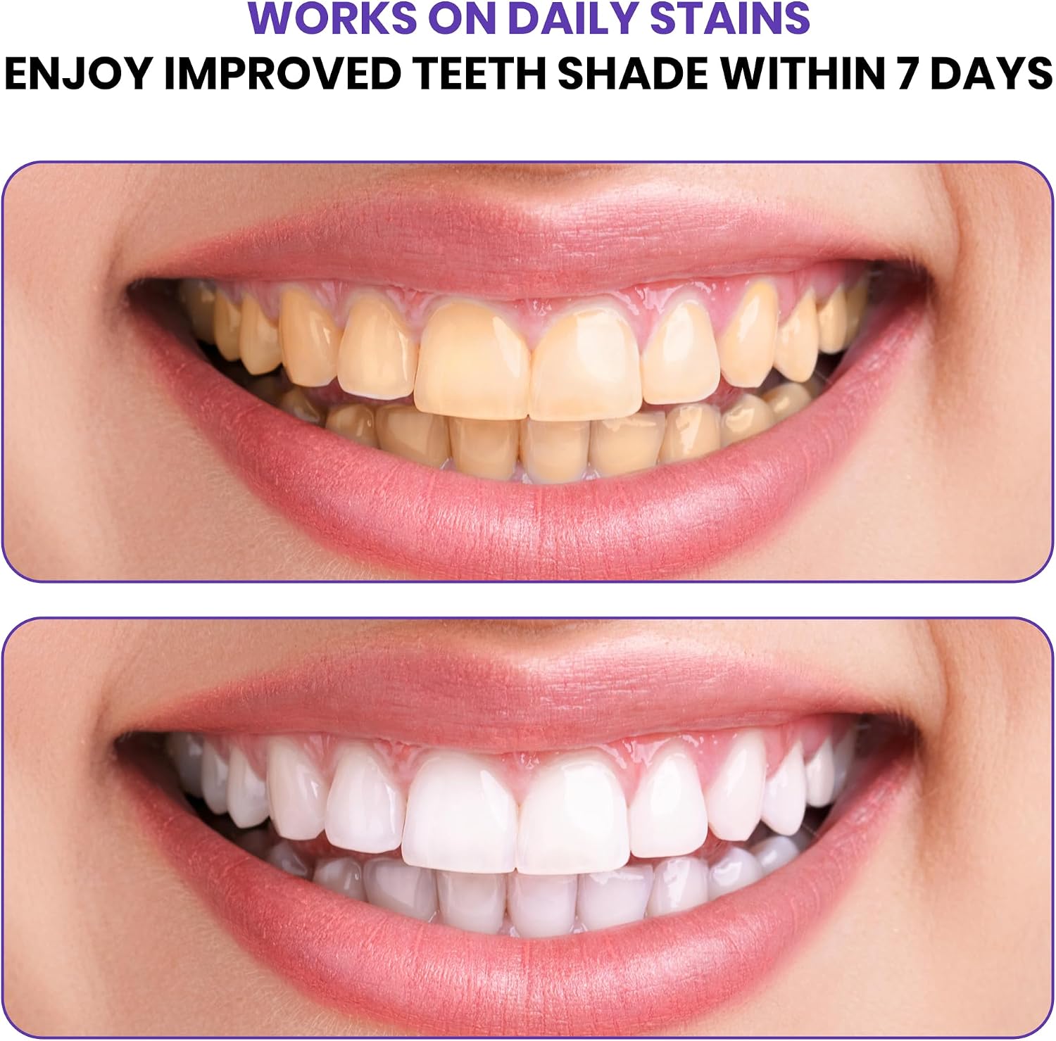 Purple Teeth Whitening Strips | Professional Teeth Whitening & Color Correction Tech | Enamel Safe | Zero Residue | Dry & Non-Slip | Removes Coffee, Wine & Smoking Stains | 14 Strips 7-Day Supply